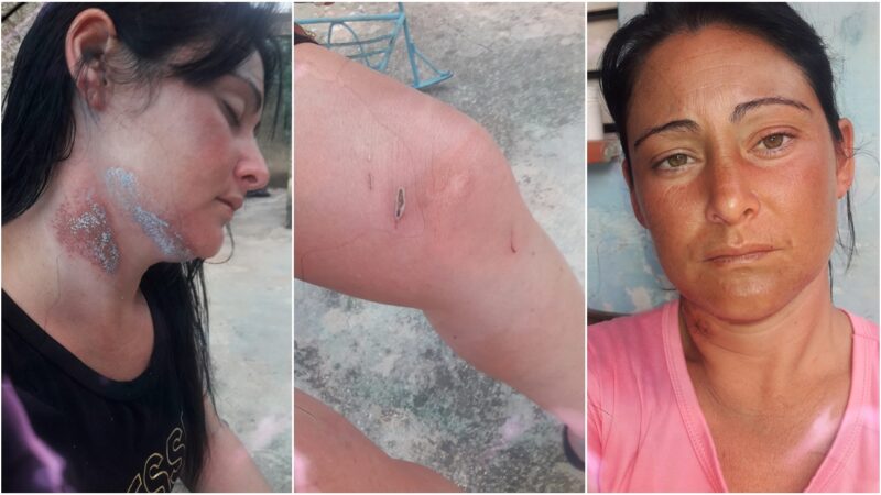 «Mi corazón está deshecho», dice balsera cubana sobreviviente de naufragio en Cárdenas donde perdió a su hermana